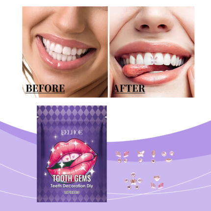 Tooth-decoration Rhinestone Decorative Shining Stickers Improve Smile Brightness